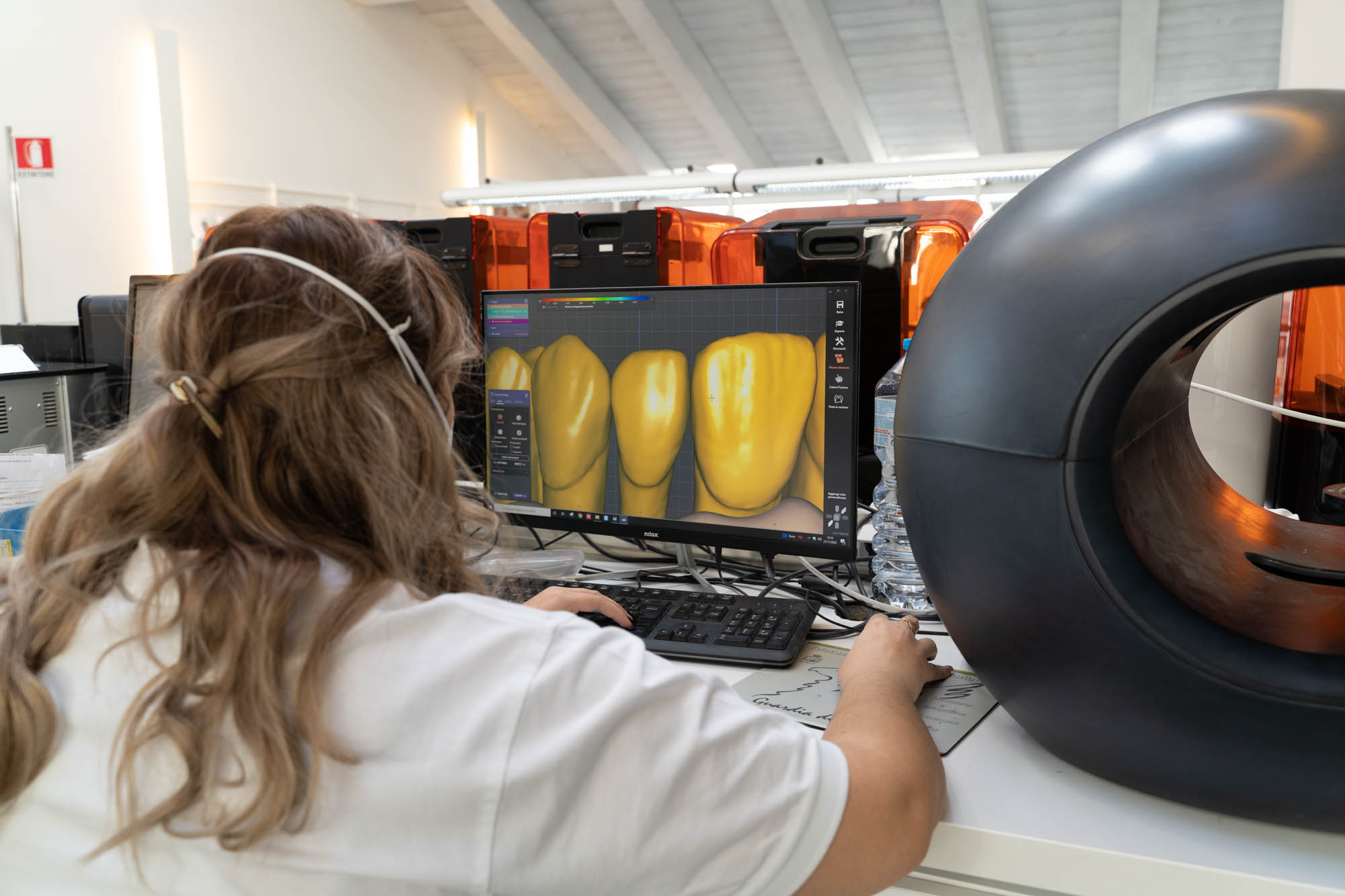 Tommaso grandi laboratorio interno denti fissi in 24 h