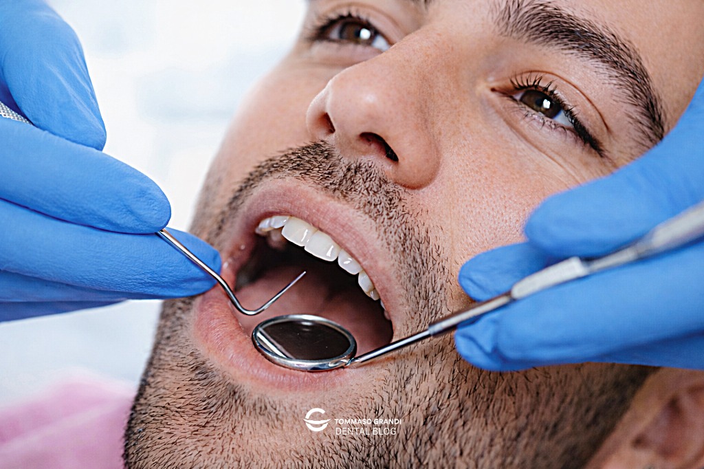 Ogni quanto fare la pulizia dei denti dal dentista