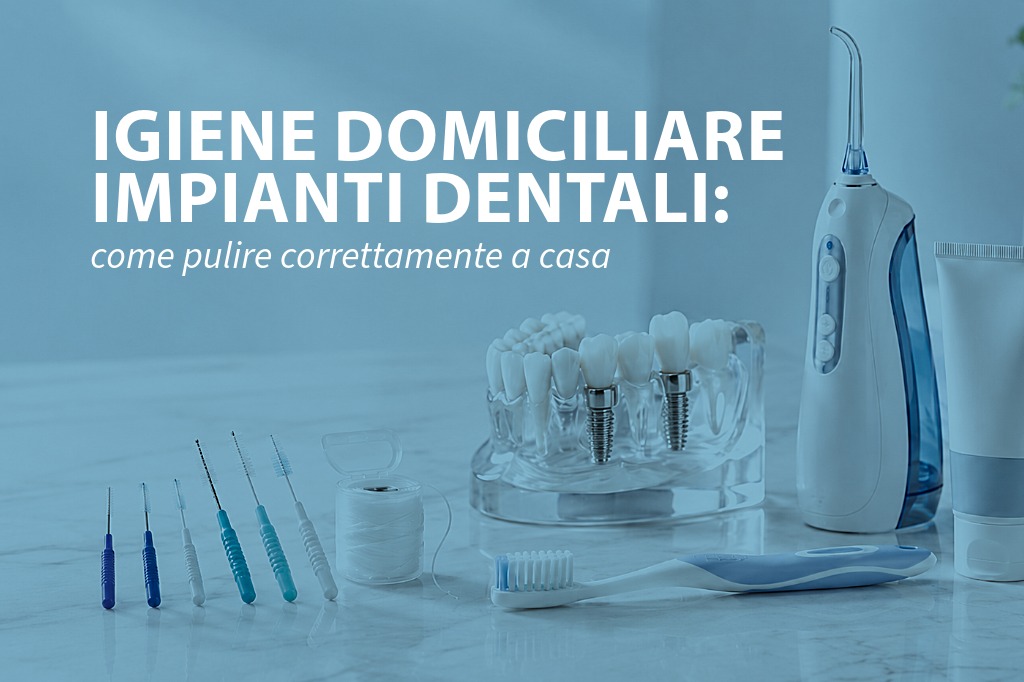 Igiene domiciliare impianti dentali: come pulire correttamente a casa