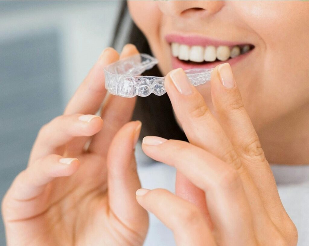 Dental treatment – orthodontics with clear aligners